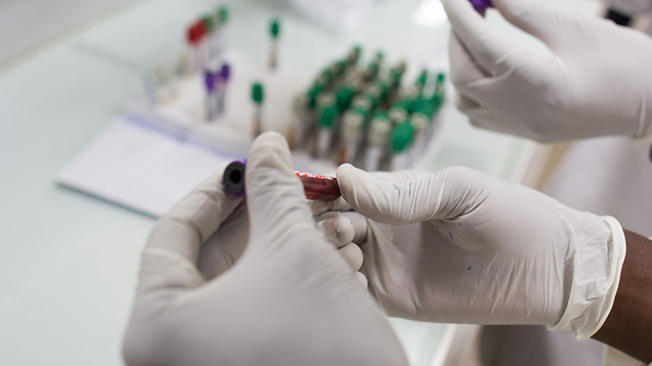 Gloved hands handling tubes with red liquid for tuberculosis screening test .