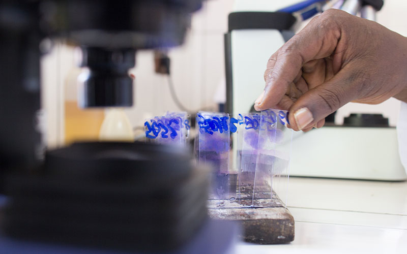 Hand aligning labeled microscope slides on a rack near a microscope in a laboratory.